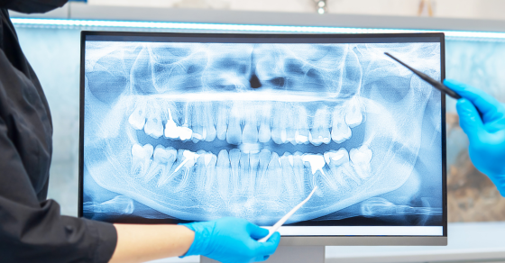 The Importance of Dental X-Rays: What They Reveal and Why They’re Necessary