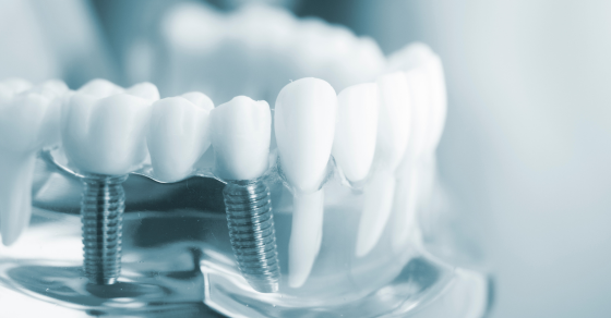 The Journey to a Perfect Smile: A Comprehensive Exploration of Cosmetic Dentistry